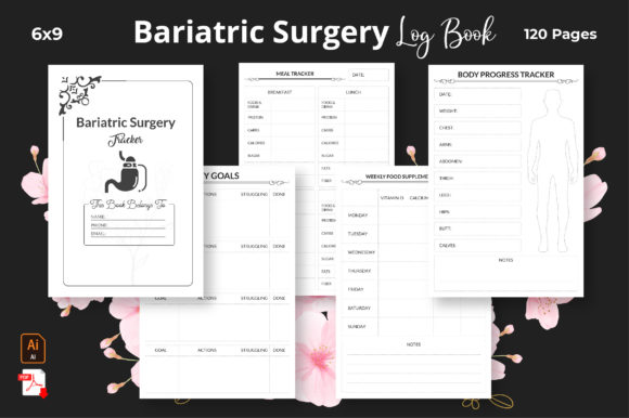 Maximize Your KDP Business with the Bariatric Surgery Tracker KDP Interior